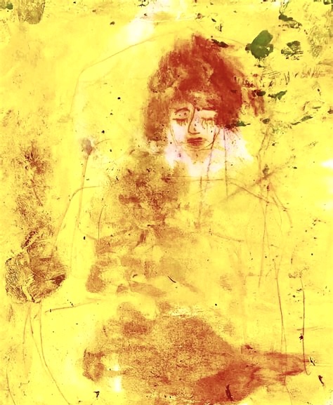 Williamson image